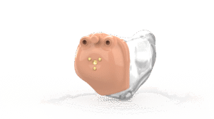 Starkey In-The-Canal (ITC) hearing aid